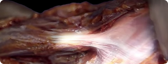 La Fascia: stimoli per riflessioni La Fascia: stimoli per riflessioni